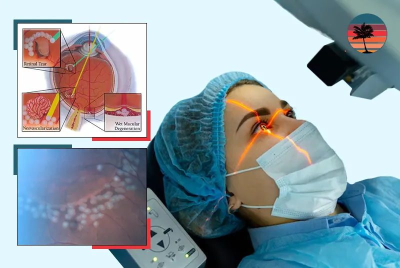 Retinal Procedures
