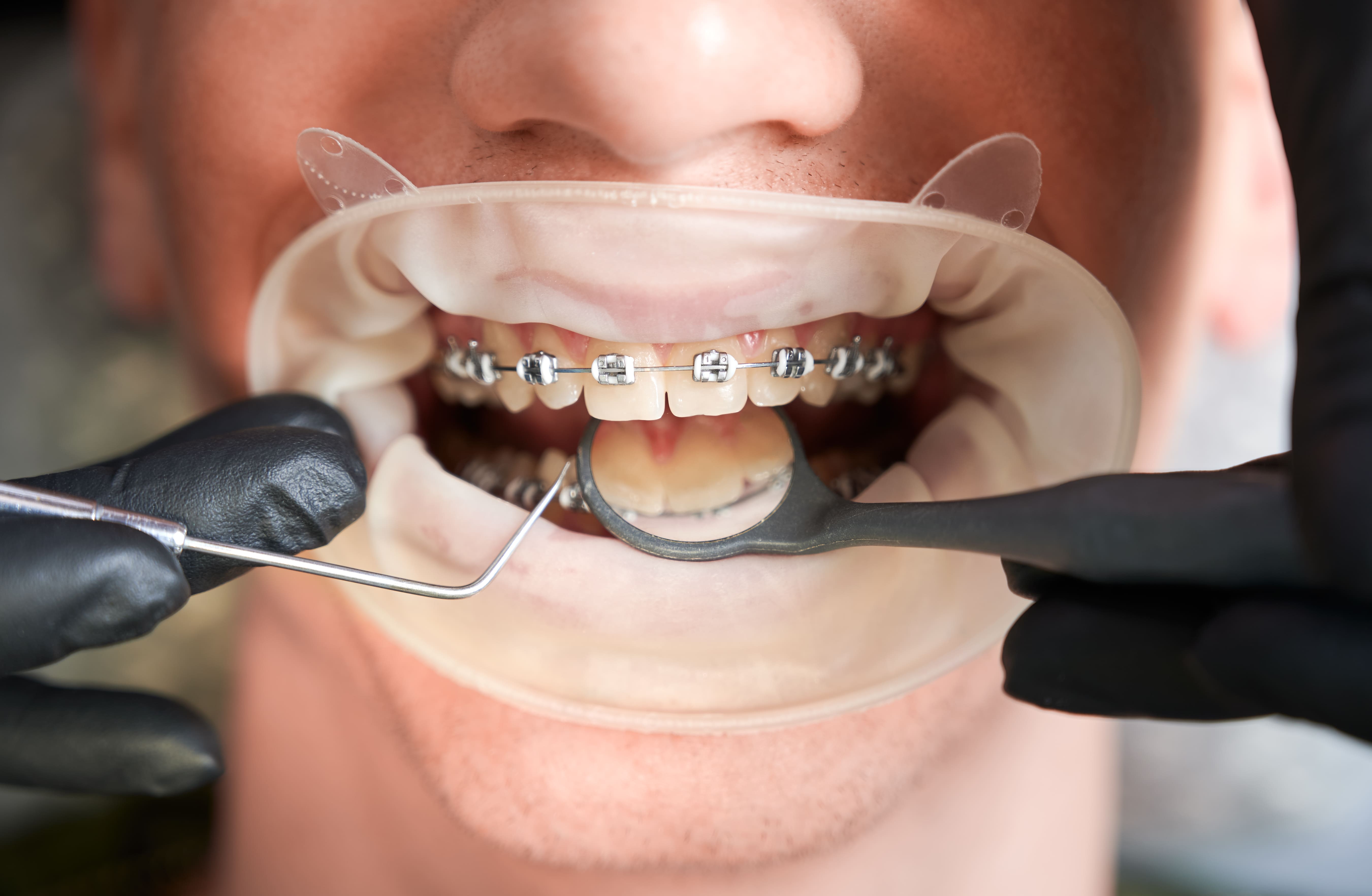 Orthodontics