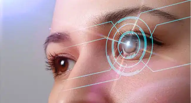 Refractive Surgery
